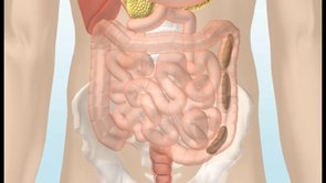 Bowel incontinence and chronic constipation