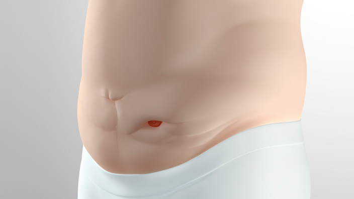 Inward peristomal area