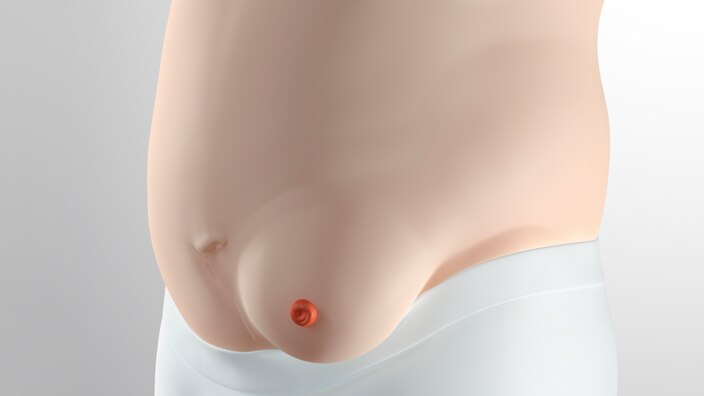 Outward peristomal area