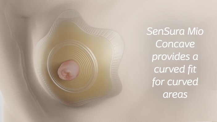 Sensura Mio Concave for curved areas
