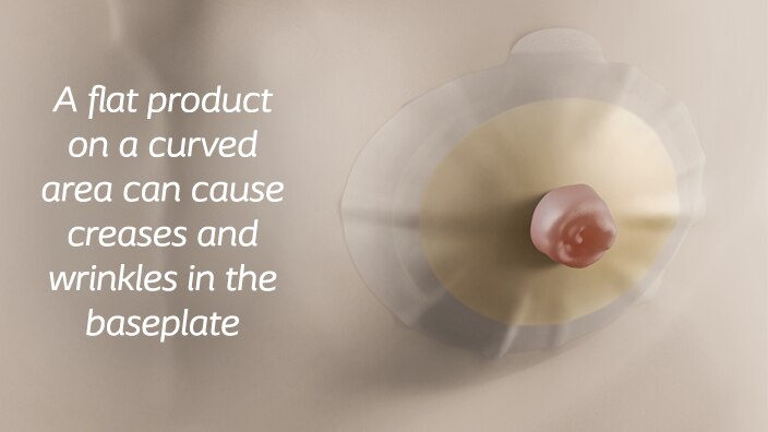 flat ostomy bag on hernia